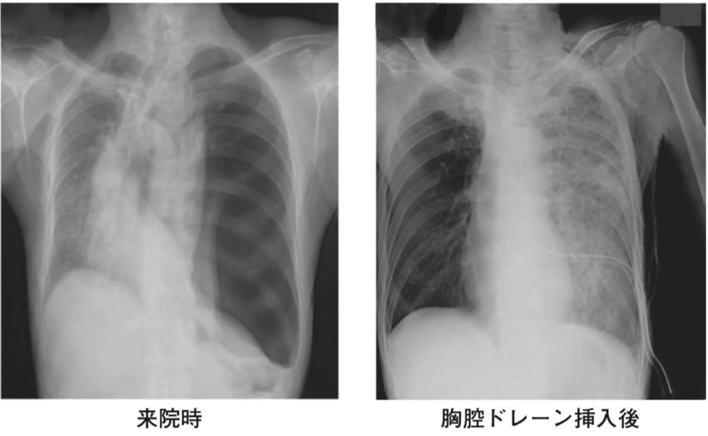116A20の問題画像