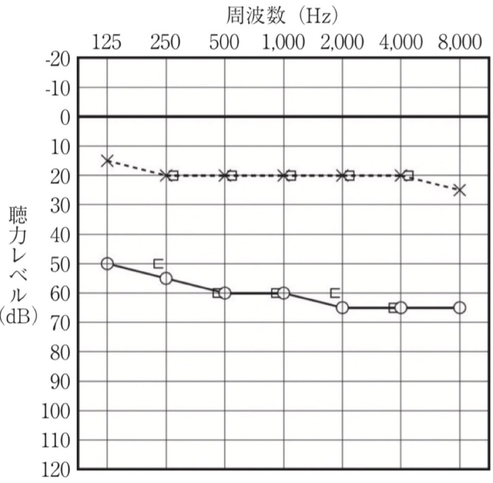 116A41の問題画像