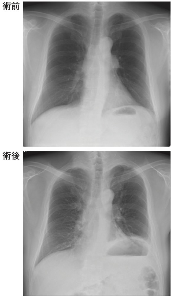 117A55の問題画像