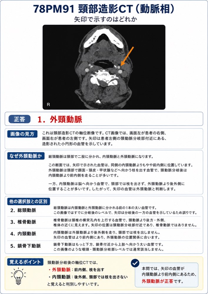 78PM91の解説画像