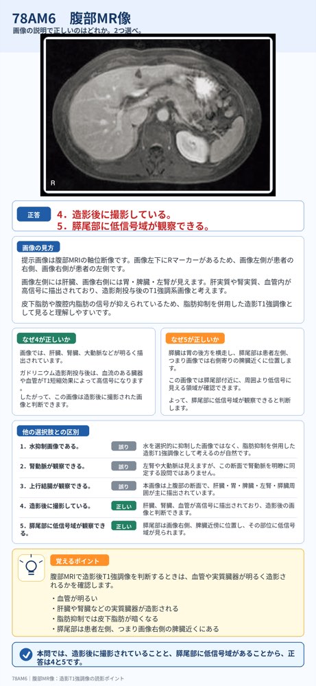 78AM6の解説画像