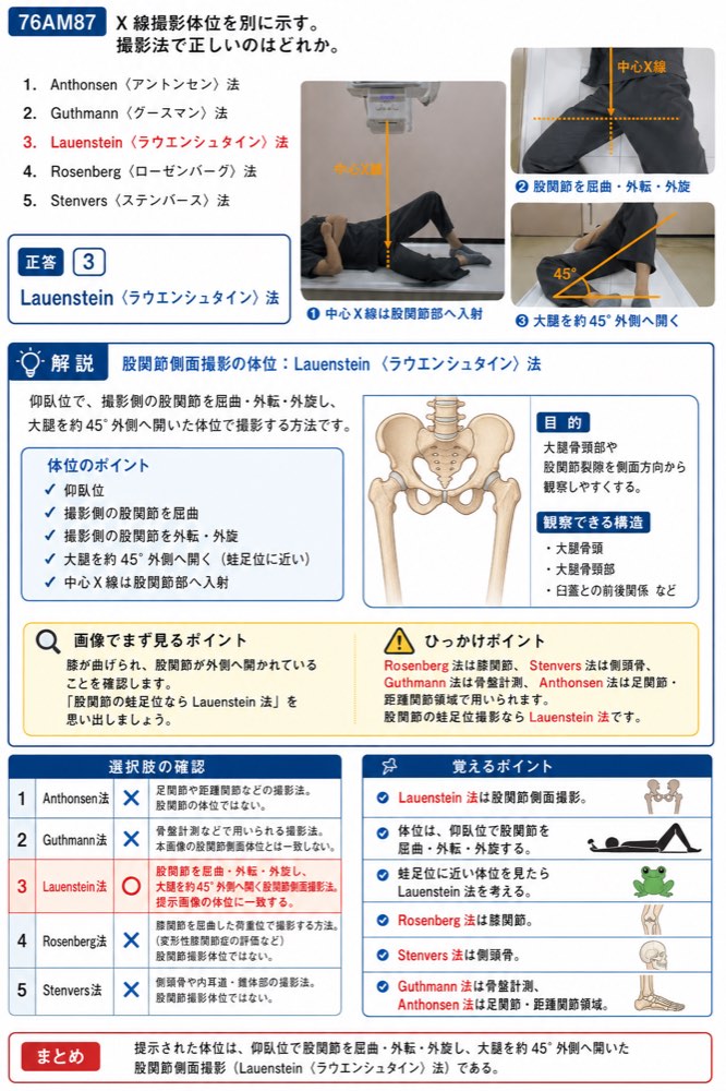 76AM87の解説画像
