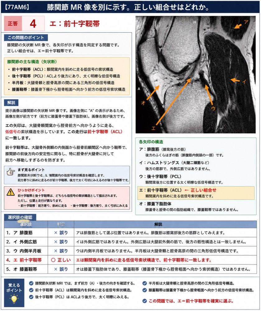 77AM6の解説画像