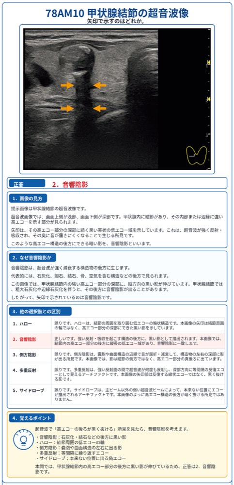 78AM10の解説画像