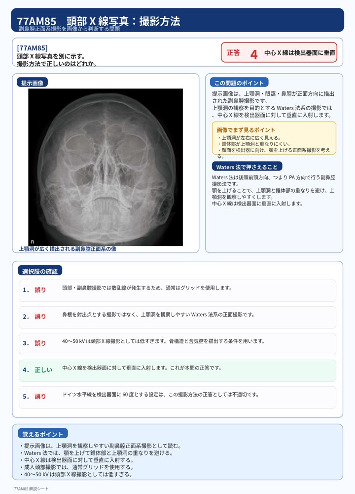 77AM85の解説画像