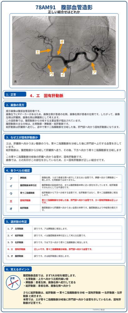 78AM91の解説画像
