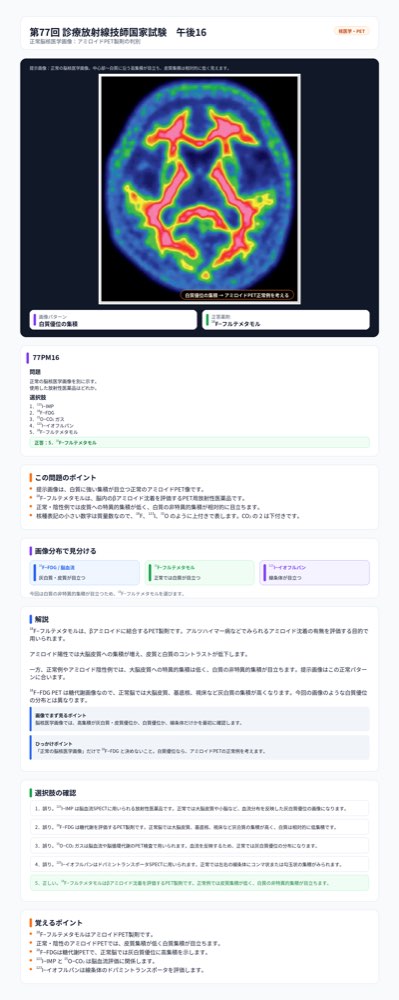 77PM16の解説画像